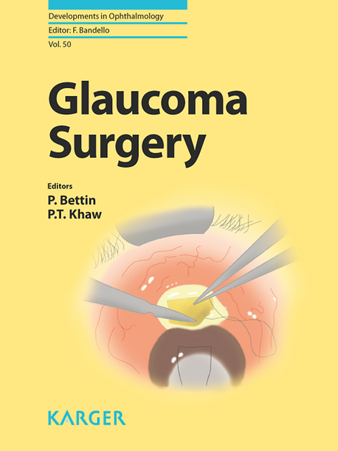 Glaucoma Surgery - 