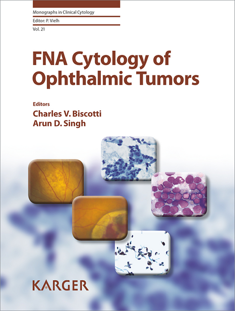 FNA Cytology of Ophthalmic Tumors - 