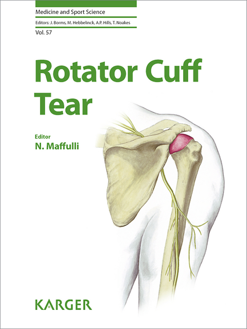 Rotator Cuff Tear - 