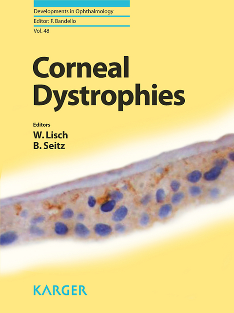 Corneal Dystrophies - 