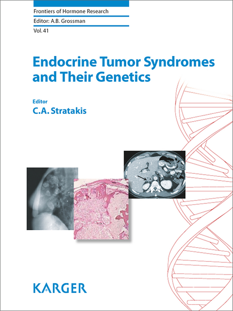 Endocrine Tumor Syndromes and Their Genetics - 