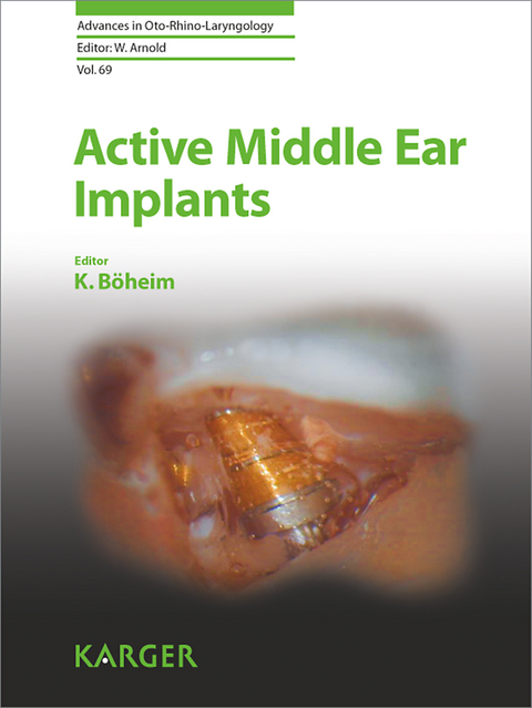 Active Middle Ear Implants - 