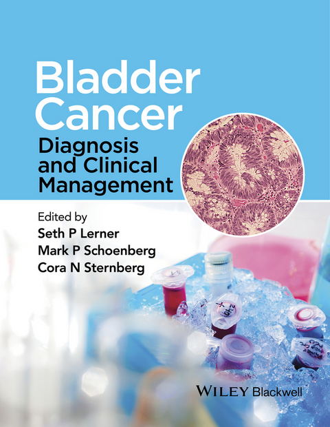 Bladder Cancer - 