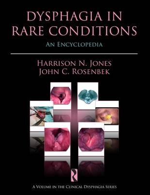 Dysphagia in Rare Conditions - Harrison N. Jones, John C. Rosenbek