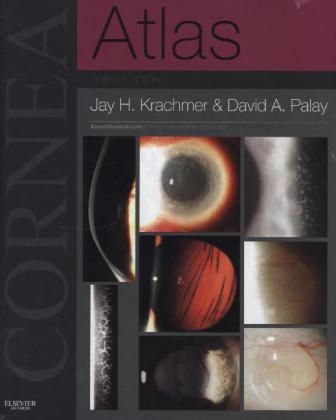 Cornea Atlas - Jay H. Krachmer, David A Palay