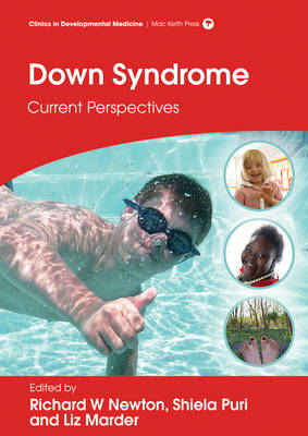 Down Syndrome -  Liz Marder,  Richard W Newton,  Shiela C Puri