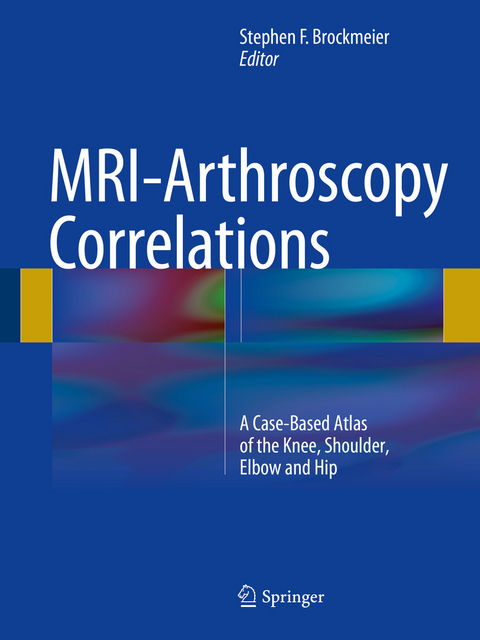 MRI-Arthroscopy Correlations - 