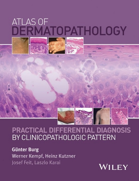 Atlas of Dermatopathology - 