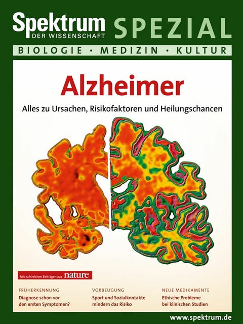 Alzheimer -  Spektrum der Wissenschaft