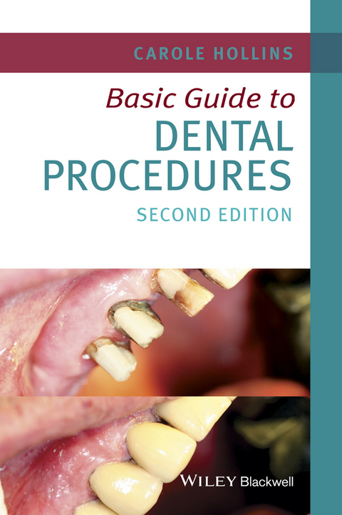 Basic Guide to Dental Procedures -  Carole Hollins