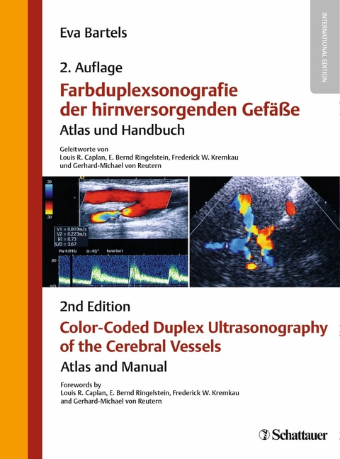 Farbduplexsonografie - Eva Bartels