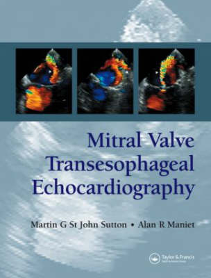 Mitral Valve Transesophageal Echocardiography -  Alan R. Maniet,  Martin G. St. John Sutton