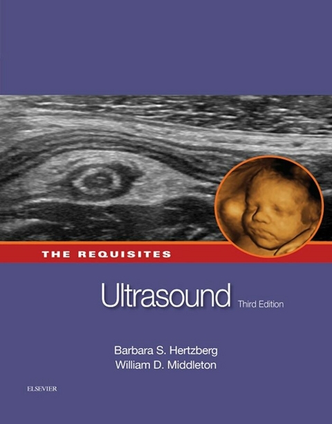 Ultrasound: The Requisites -  Barbara S. Hertzberg,  William D. Middleton