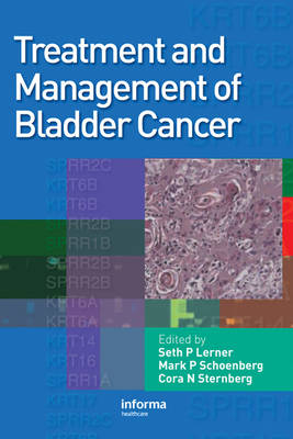 Treatment and Management of Bladder Cancer - 