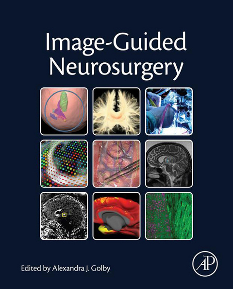 Image-Guided Neurosurgery - 