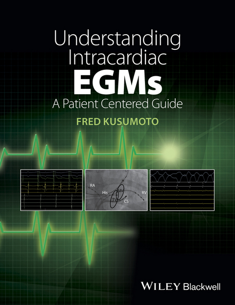 Understanding Intracardiac EGMs - Fred Kusumoto