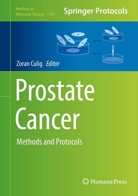 Prostate Cancer - 