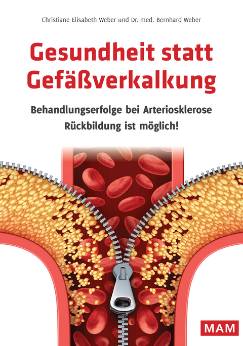 Gesundheit statt Gefäßverkalkung - Dr. med. Bernhard Weber, Christiane E. Weber