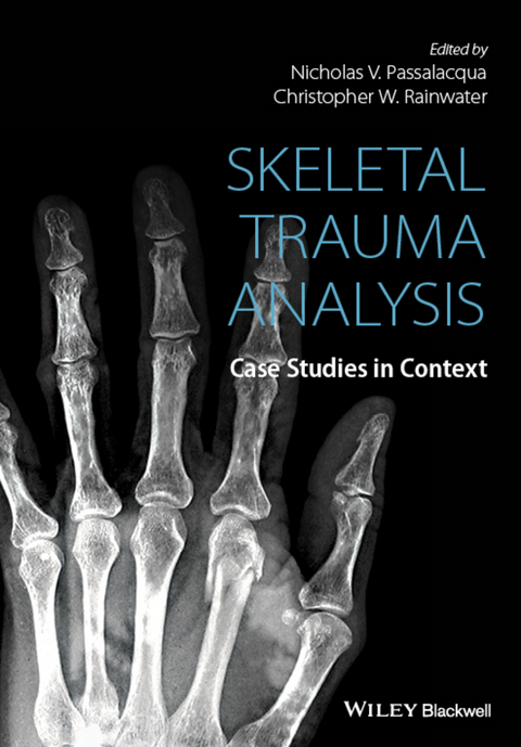 Skeletal Trauma Analysis - 