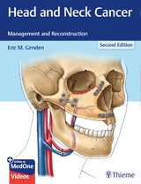 Head and Neck Cancer - Genden, Eric M.