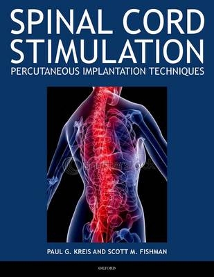 Spinal Cord Stimulation -  Scott Fishman,  Paul Kreis