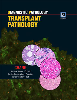 Diagnostic Pathology: Transplant Pathology - Anthony Chang, Aliya N. Husain, Dr. Ilyssa O Gordon