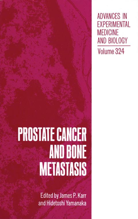 Prostate Cancer and Bone Metastasis - 