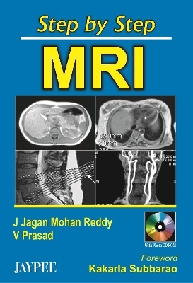 Step by Step MRI - J Jagan Mohan Reddy, V Prasad