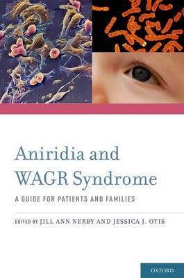 Aniridia and WAGR Syndrome - 