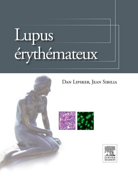 Lupus érythémateux -  Dan Lipsker,  Jean Sibilia