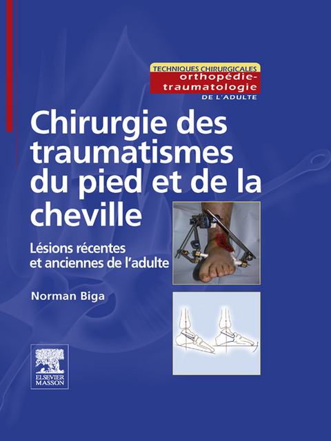 Chirurgie des traumatismes du pied et de la cheville -  Norman Biga