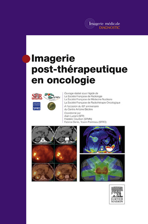 Imagerie post-thérapeutique en oncologie -  Centre Antoine Beclere,  Frederic Courbon,  Fabrice DENIS,  Alain Luciani,  Societe Francaise de Medecine Nucleaire,  Ste Francaise Radiotherapie Oncologique,  Yoann Pointreau,  Societe Francaise de Radiologie