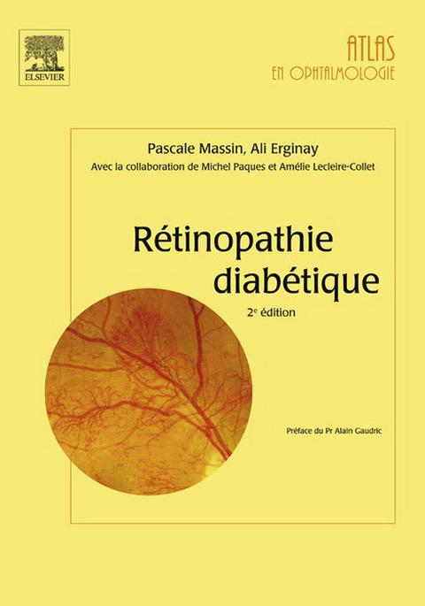 Rétinopathie diabétique -  Ali Erginay,  Pascale Massin