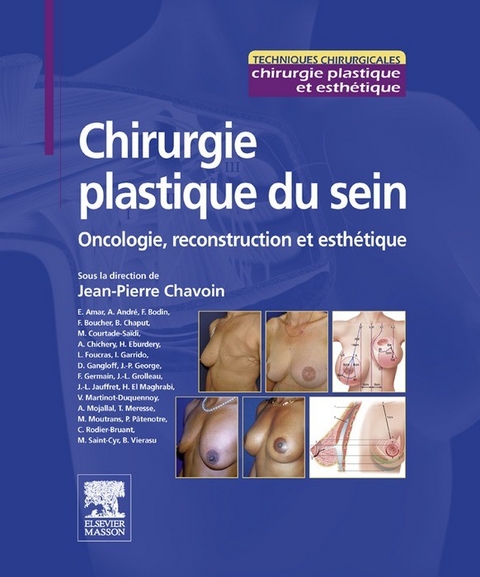 Chirurgie plastique du sein -  Jean-Pierre Chavoin