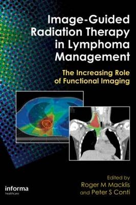 Image-Guided Radiation Therapy in Lymphoma Management - 