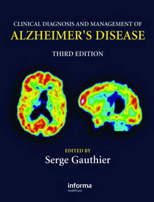 Clinical Diagnosis and Management of Alzheimer's Disease - 