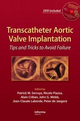 Transcatheter Aortic Valve Implantation - 