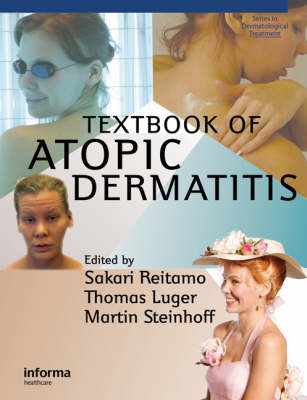 Textbook of Atopic Dermatitis -  Thomas A. Luger,  Sakari Reitamo,  Martin Steinhoff