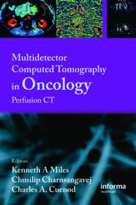 Multi-Detector Computed Tomography in Oncology - 