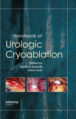 Handbook of Urologic Cryoablation - 