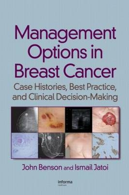 Management Options in Breast Cancer -  John Benson,  Ismail Jatoi