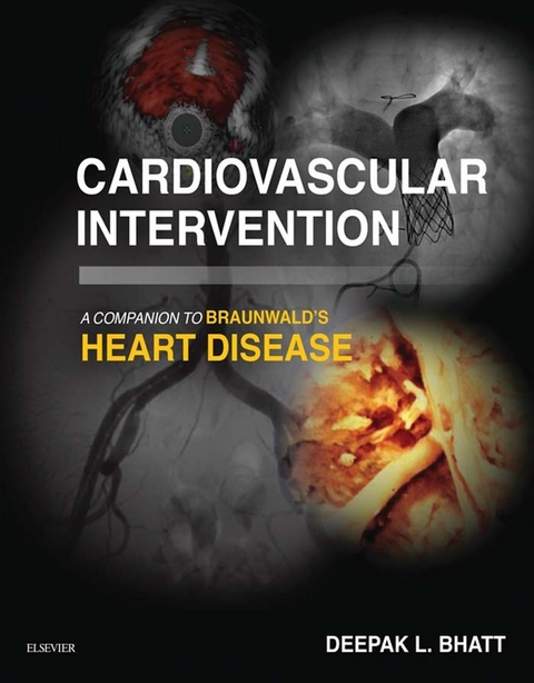 Cardiovascular Intervention: A Companion to Braunwald's Heart Disease E-Book - 