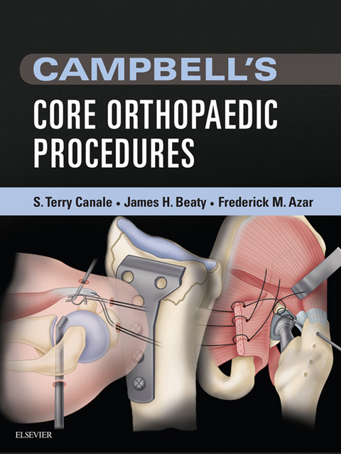 Campbell's Core Orthopaedic Procedures -  S. Terry Canale,  James H. Beaty,  Frederick M Azar