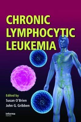 Chronic Lymphocytic Leukemia - 