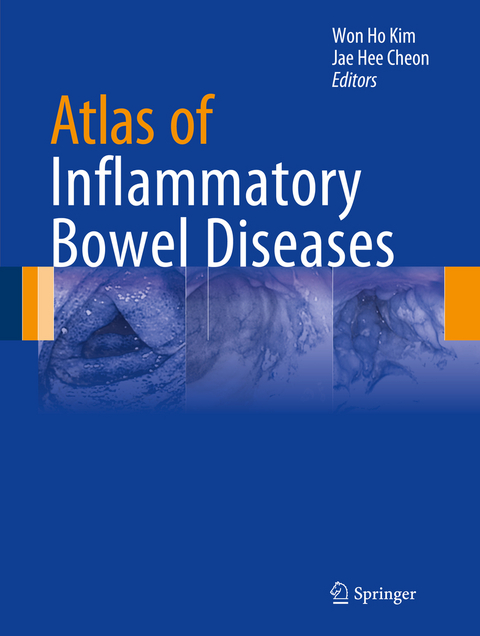 Atlas of Inflammatory Bowel Diseases - 