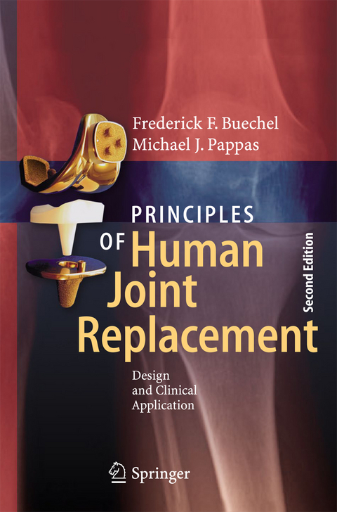 Principles of Human Joint Replacement - Frederick F. Buechel, Michael J. Pappas