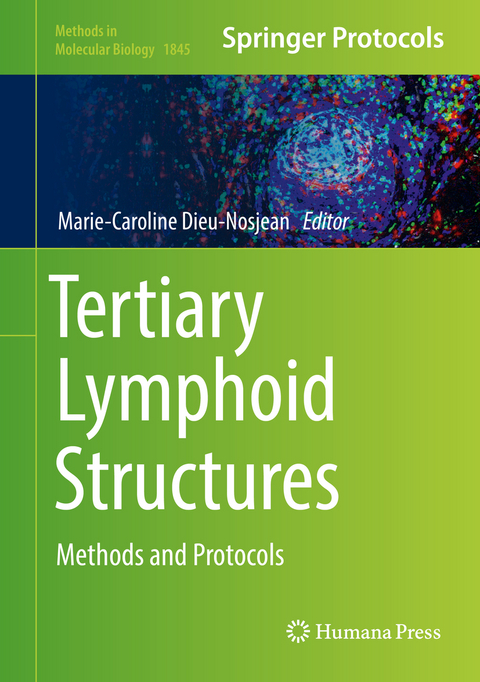 Tertiary Lymphoid Structures - 