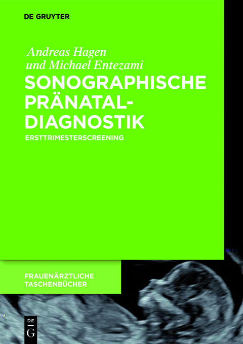 Sonographische Pränataldiagnostik - Andreas Hagen, Michael Entezami