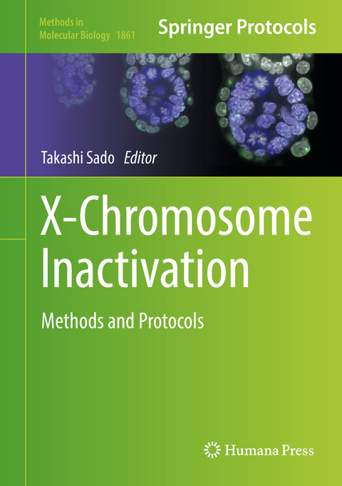 X-Chromosome Inactivation - 