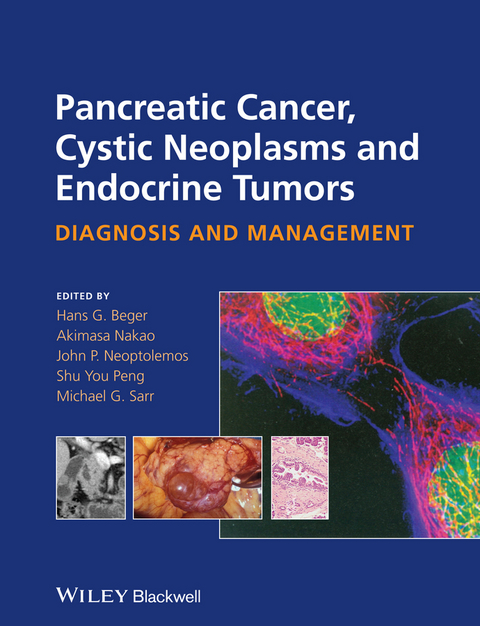 Pancreatic Cancer, Cystic Neoplasms and Endocrine Tumors - 